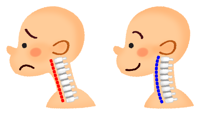 相模原市南区相模大野でストレートネックを根本改善！ひどい頭痛・肩こりとお別れする方法